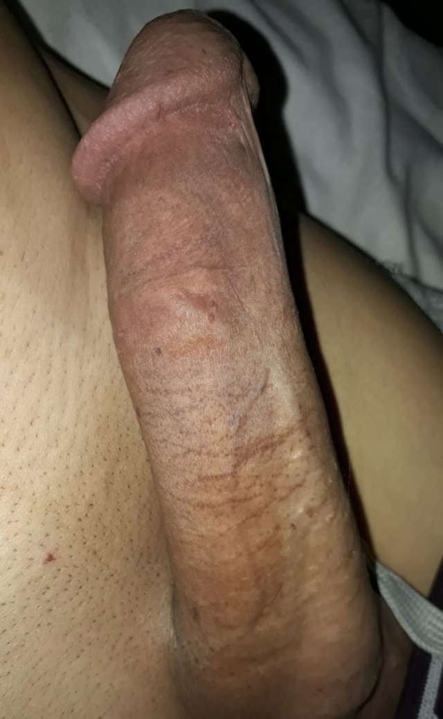1000003276